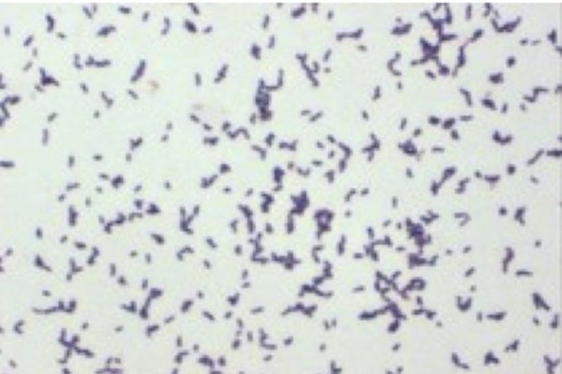 Szczecin: trzeci pacjent z podejrzeniem zakażenia Escherichia coli