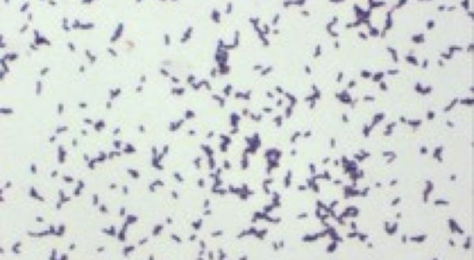 Bełchatów: kolejna osoba z podejrzeniem zakażenia bakterią E. coli