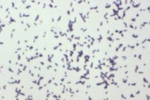 Powszechnie występujące bakterie Escherichia coli i Bacteroides fragilis sprzyjają rozwojowi guzów jelita grubego. Fot. Archiwum Co najmniej trzy typy bakterii sprzyjają rakowi jelita grubego