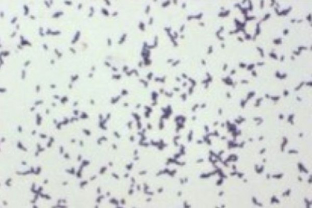Niemcy: bakteria coli coraz groźniejsza