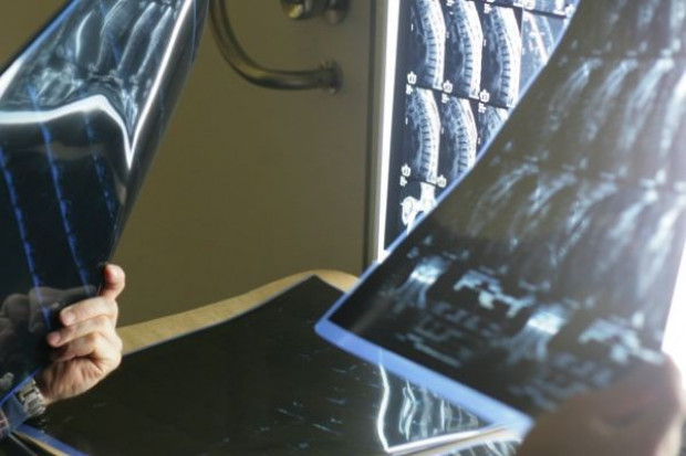 Białystok: nie ma sprzętu do odczytywania zdjęć radiologicznych