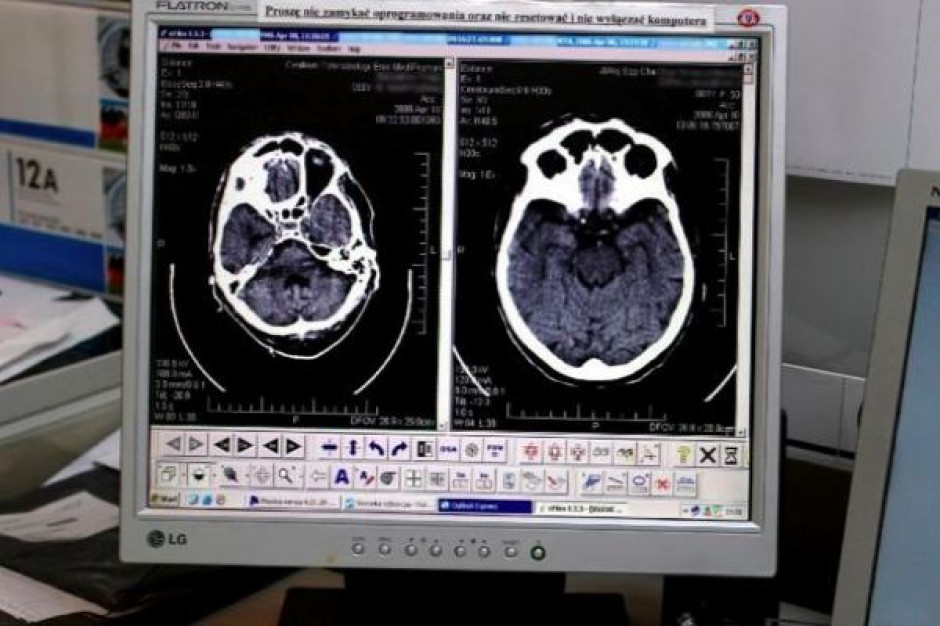 Czy tomografię zastapią okulary rozszerzonej rzeczywistości? Fot. Archiwum Rozszerzona rzeczywistość może się przydać w kardiologii