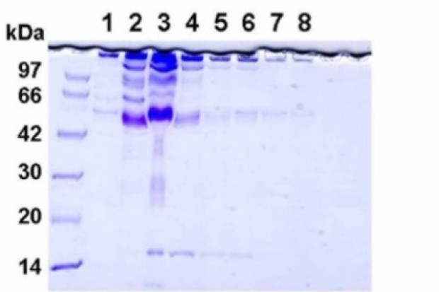 Nowy biomarker reumatoidalnego zapalenia stawów?