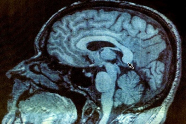 Toruń: UMK rozpocznie współpracę z Coma Science Group