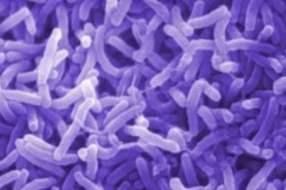 Haiti: za epidemię cholery odpowiada ONZ?