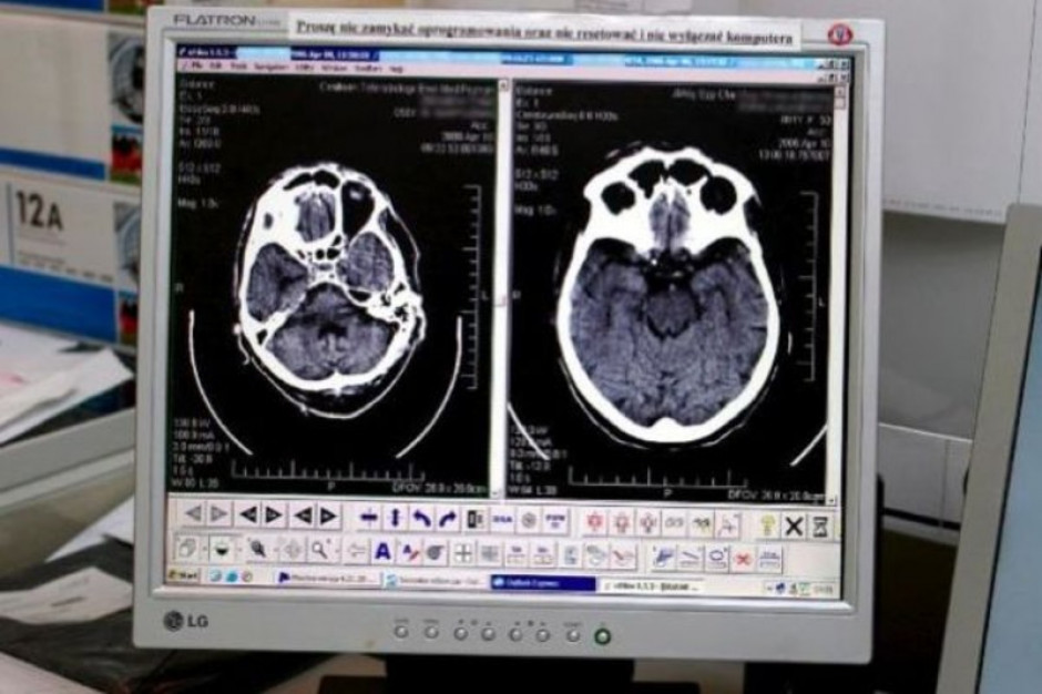 Śląskie: siemianowicka oparzeniówka otworzyła pracownię tomograficzną