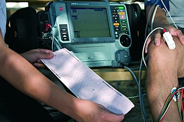 Niemcy: EKG może wiele powiedzieć o naszej osobowości