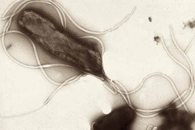 Rifabutin przy nieskutecznej eradykacji zakażenia Helicobacter pylori