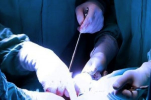 Olsztyn: nowatorska operacja 7-latka ze zdeformowaną twarzą
