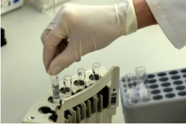 Lublin: bezpłatne badania laboratoryjne