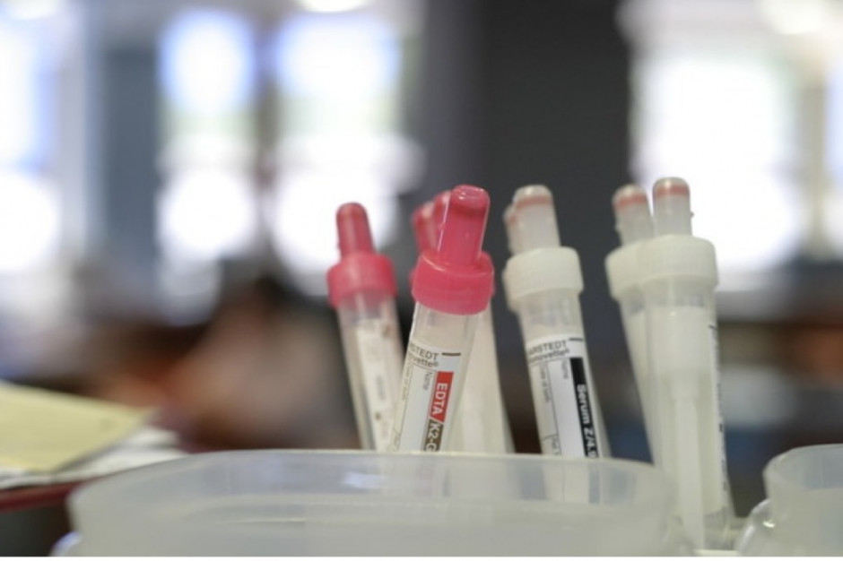 Warszawa: inauguracja projektu "Zapobieganie zakażeniom HCV"