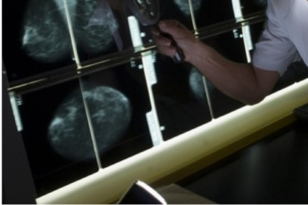 FFS: warsztaty dla radiologów z zakresu mammografii skryningowej