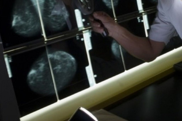 Wojewódzki Szpital Specjalistyczny w Radomiu kupi nowoczesny mammograf