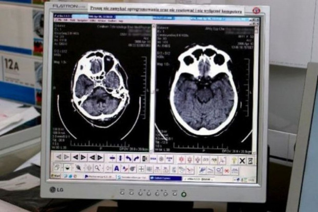 Lux Med Diagnostyka w gdańskim Szpitalu Swissmed