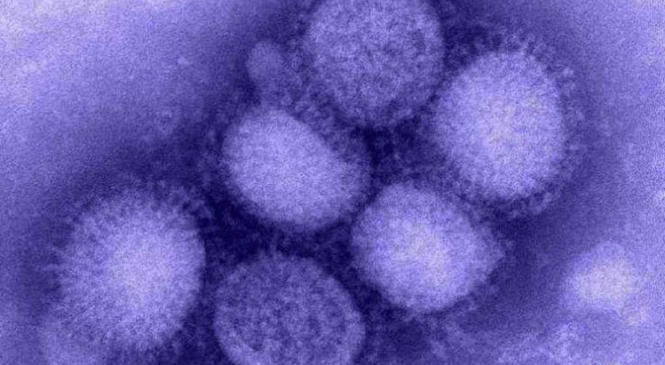 Grypa A/H1N1 stwierdzana niemal w całym kraju