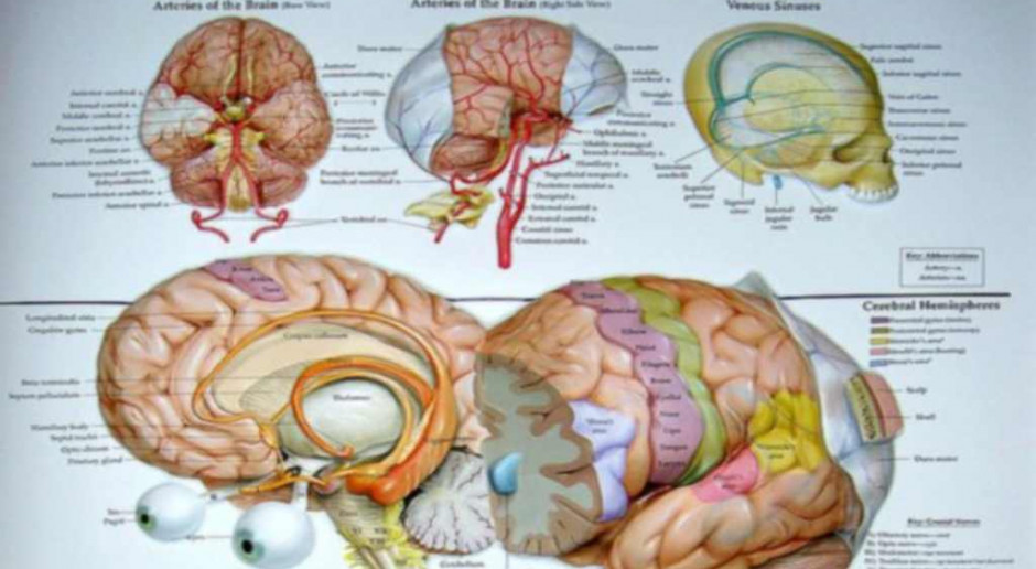 Z najnowocześniejszej terapii udaru mózgu korzysta niewielu