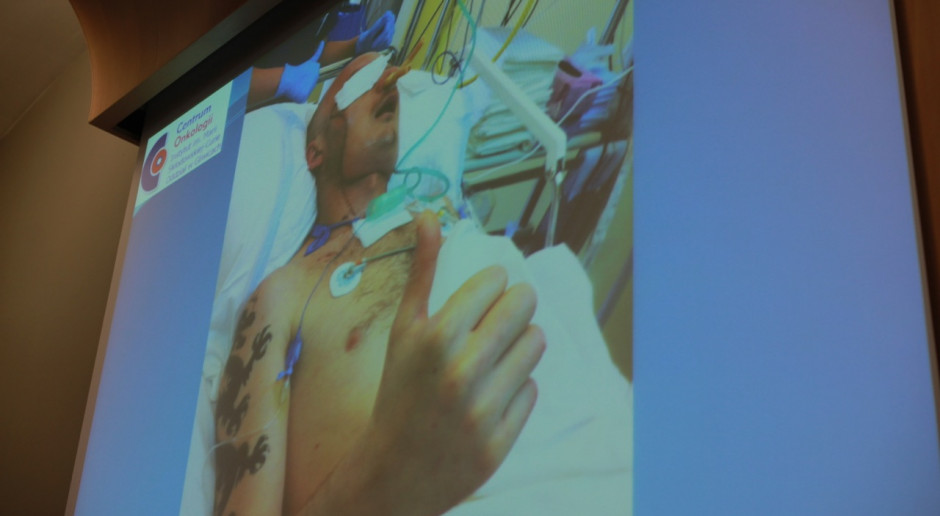 Gliwice: pacjent po przeszczepie twarzy opuścił OITM - mówi, uczy się połykać