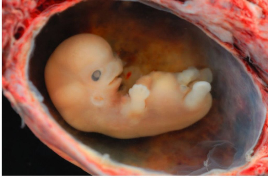 Największa w historii Irlandii demonstracja antyaborcyjna