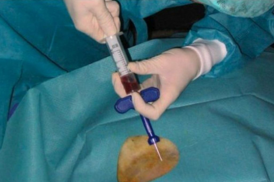 Opole: otwarto nowoczesny oddział hematologii