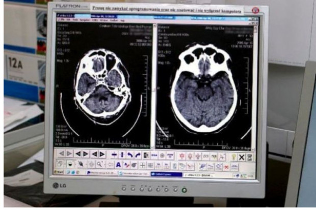 Małopolska: po kontrolach w pracowniach rezonansu magnetycznego i tomografii
