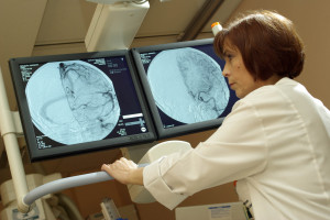 Metoda obrazowania chorób serca CCTA może ograniczyć "czyste angiografie"