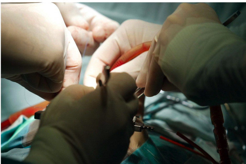 MZ o wspieraniu rejestrów transplantacyjnych