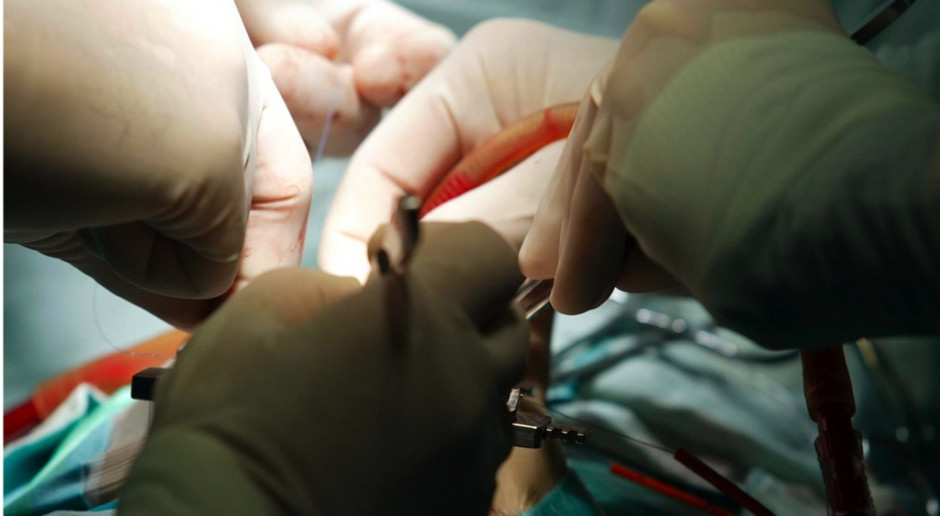 MZ o wspieraniu rejestrów transplantacyjnych