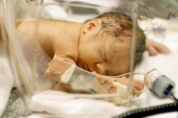Opieka nad wcześniakiem: oddział neonatologiczny i... co dalej?