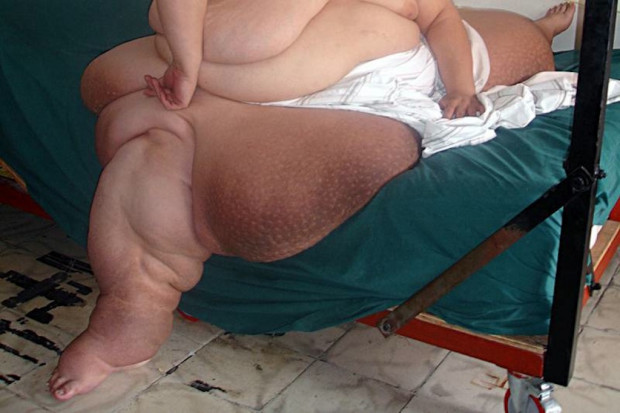 Najcięższa kobieta świata lżejsza o 300 kg. Fot. Archiwum Najcięższa kobieta świata lżejsza o 300 kg