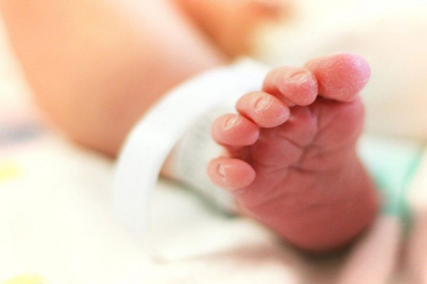 Neonatolodzy: syjamskie bliźniaki mają się dobrze