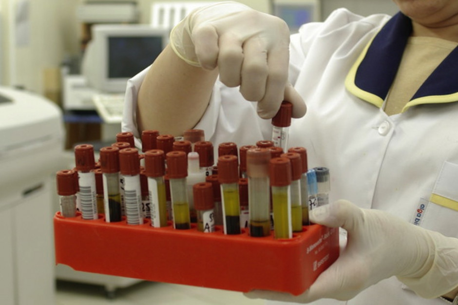Diagnostyka laboratoryjna czeka cierpliwie w kolejkowym pakiecie