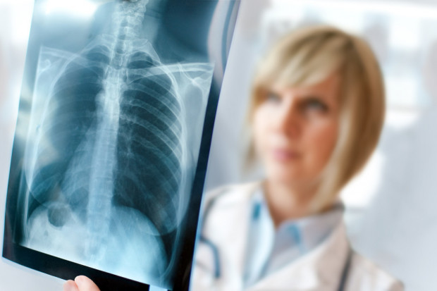 Kalisz: będą kształcić radiologów