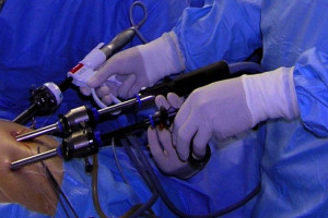 Łódz: szpital filmuje i archiwizuje zabiegi laparoskopowe