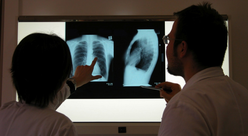 TNS: co Polacy sądzą o bezpieczeństwie badań rentgenowskich