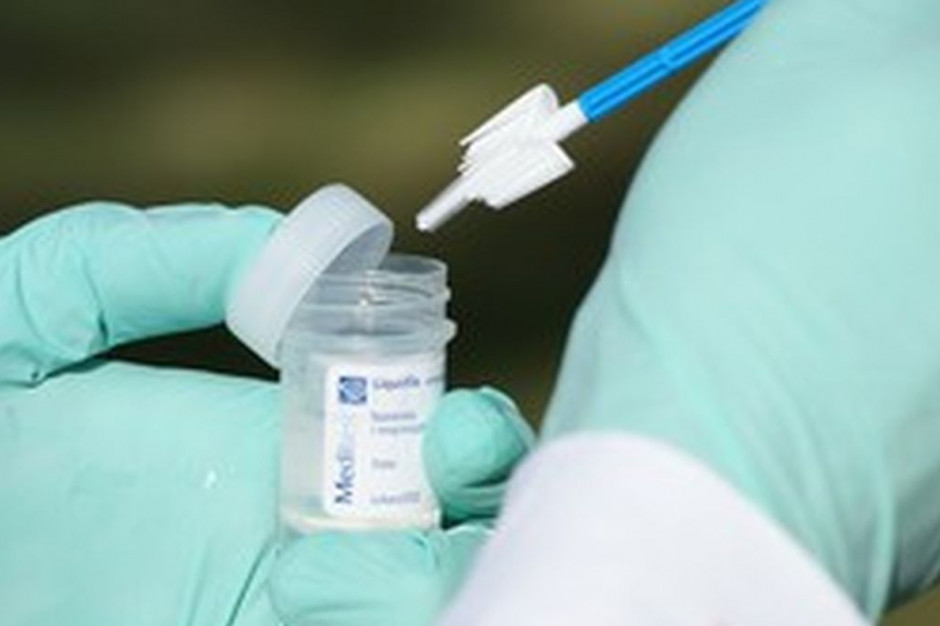 Małopolska: 11,5 mln zl na bezpłatne badania profilaktyczne