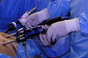 Kraków: przeprowadzili zabieg podwieszenia macicy metodą laparoskopową