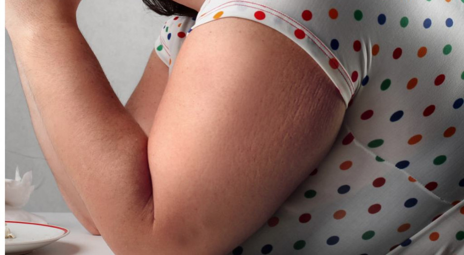 Napadowe objadanie się może być poskromione przez estrogen