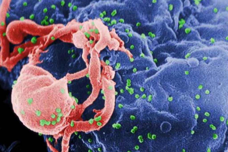Wirus HIV, Fot. archiwum RZ Nowicka: środki na profilaktykę HIV/AIDS powinny być wyższe