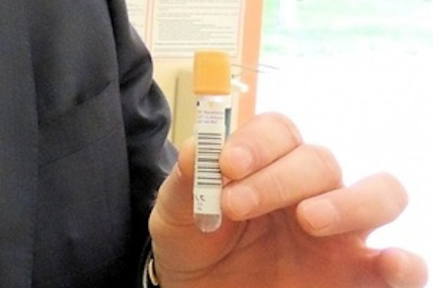 Próbka krwi. Fot. archiwum Pomorskie: kolejki do hematologów spowodowane m.in. brakiem specjalistów