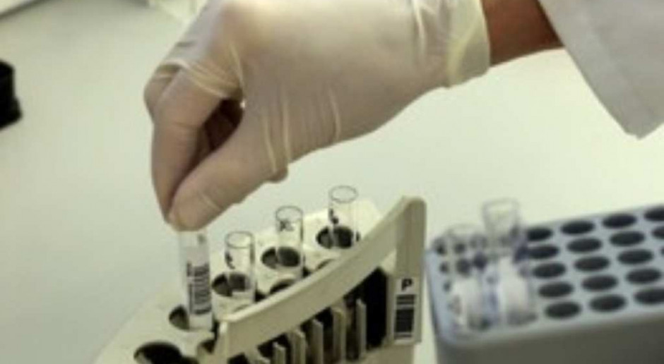 Arłukowicz: PZH przez całą dobę gotowy do diagnozowania eboli