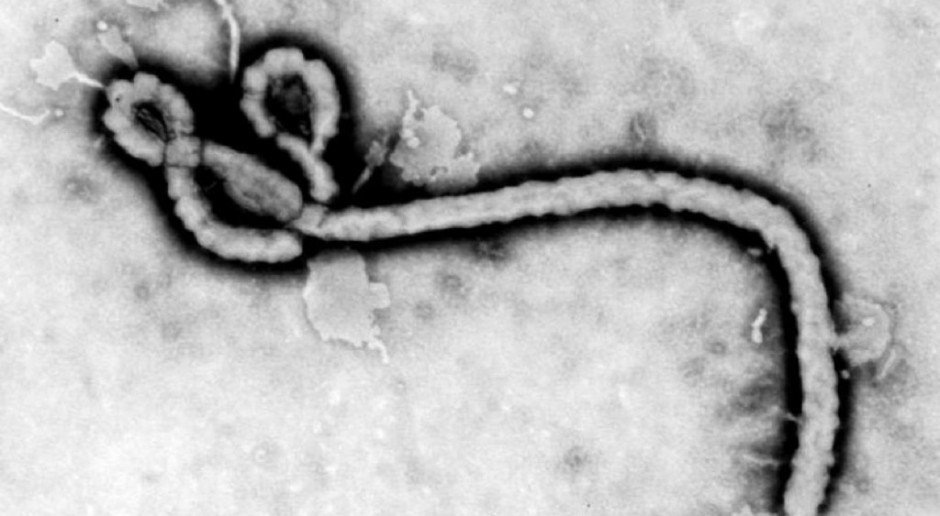 Warszawa: pacjent z podejrzeniem zakażenia wirusem ebola