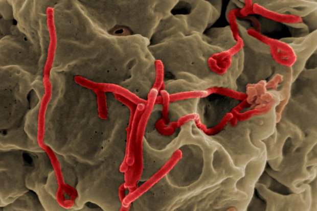 WHO akceptuje pierwszy szybki test na ebolę