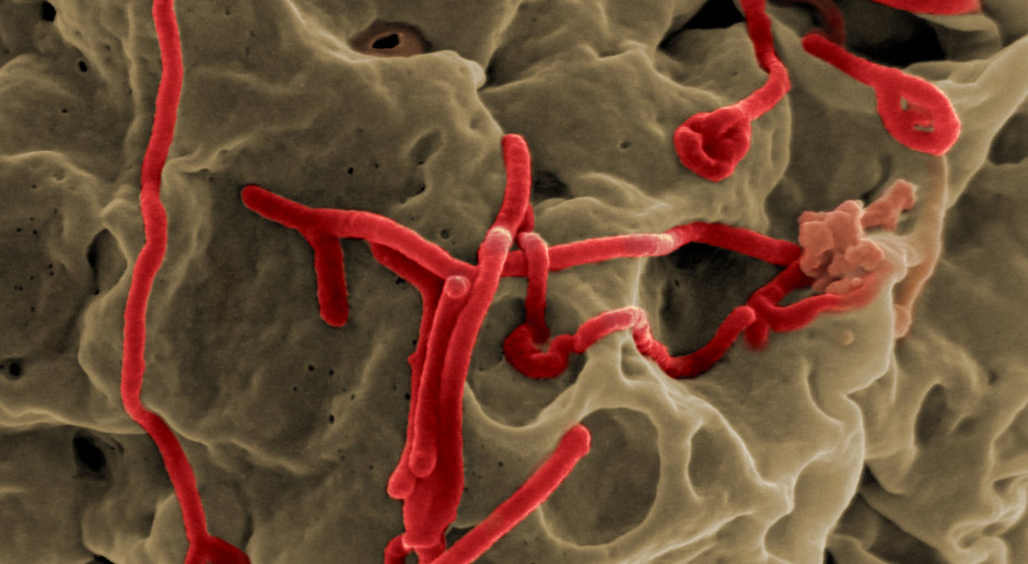 Badanie nt. eboli odpowiada na niektóre pytania związane z epidemią