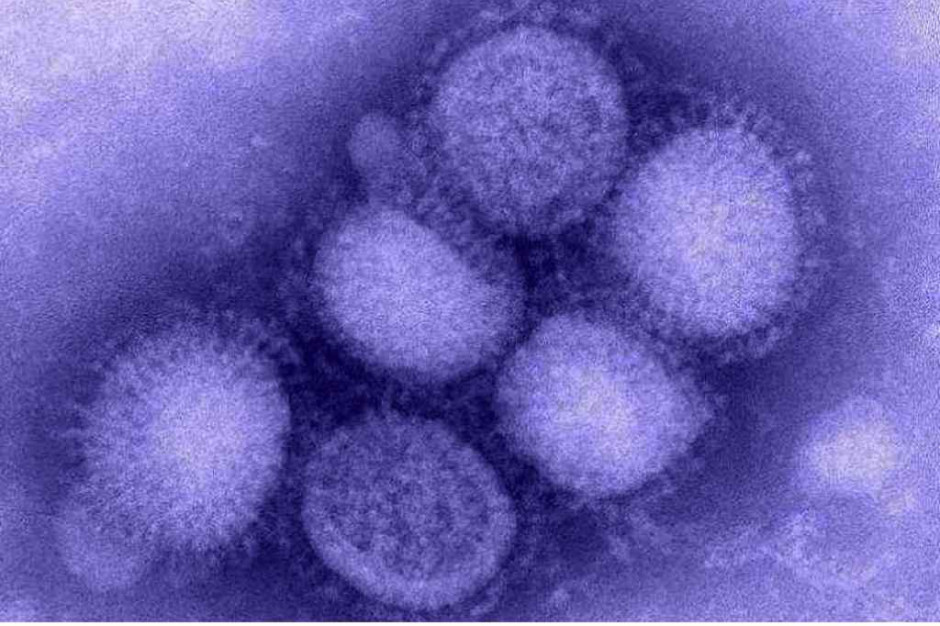 Rosja: 12 osób zmarło na świńską grypę (wirus H1N1). Fot. Archiwum Rosja: 12 osób zmarło na świńską grypę