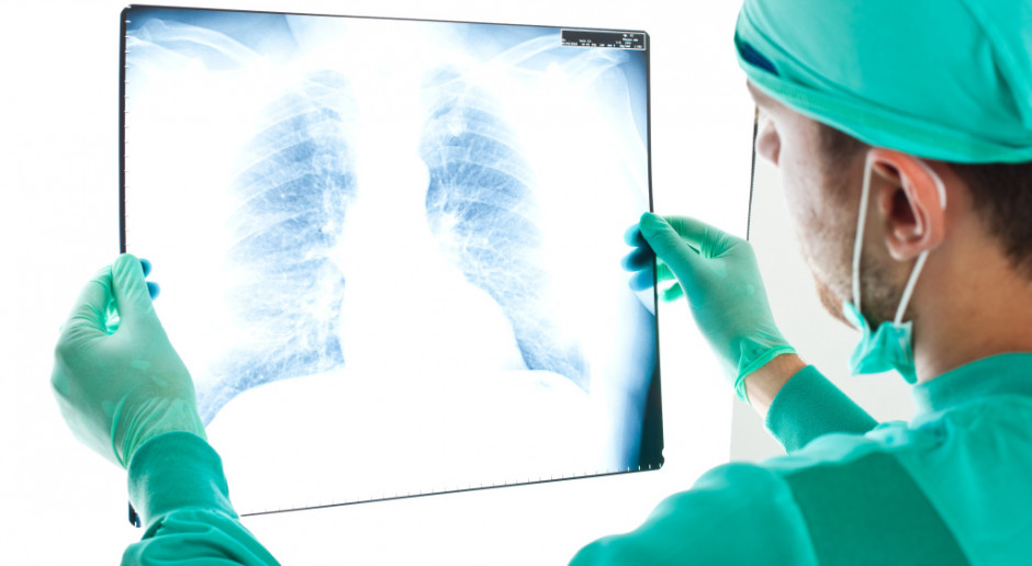 Wrocław: DCO wprowadza nowoczesną metodę diagnozowania guzów płuca