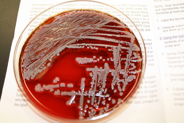 Bakterie Staphylococcus aureus powodują poważne infekcje. Fot. Flickr/VeeDunn (CC BY 2.0) Naukowcy odkryli mechanizm, który ma pomóc w walce z gronkowcem złocistym