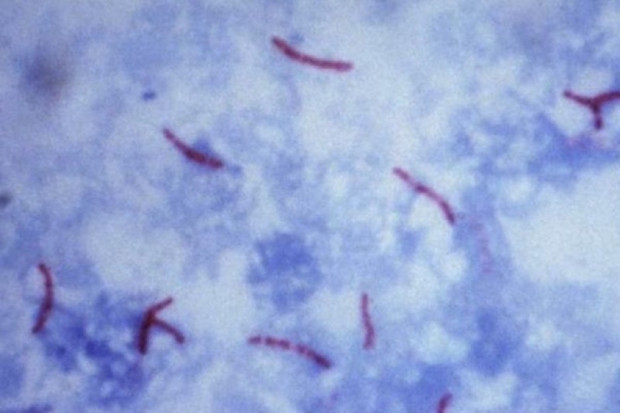 Prątki gruźlicy Fot. Archiwum MZ: sytuacja epidemiologiczna dot. gruźlicy w Polsce - dobra