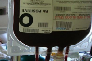 Biomed-Lublin zaczął zawierać umowy z centrami krwiodawstwa na dostawy osocza