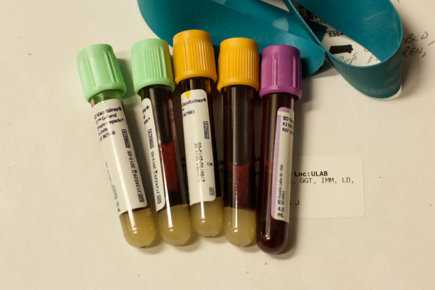 Inwestucja ma skrócić czas oczekiwania na wyniki badań molekularnych, cytogenetycznych oraz histopatologicznych. Fot. Phillip Jeffrey/Flickr (CC BY-SA 2.0) Gorzów Wielkopolski: diagnostyka hematologiczna będzie szybsza