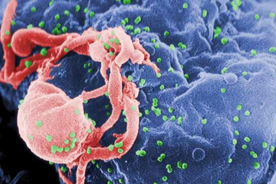 Wirus HIV Fot. Archiwum Wczesna terapia dzieci urodzonych z wirusem HIV umożliwia odstawienie leków na lata?